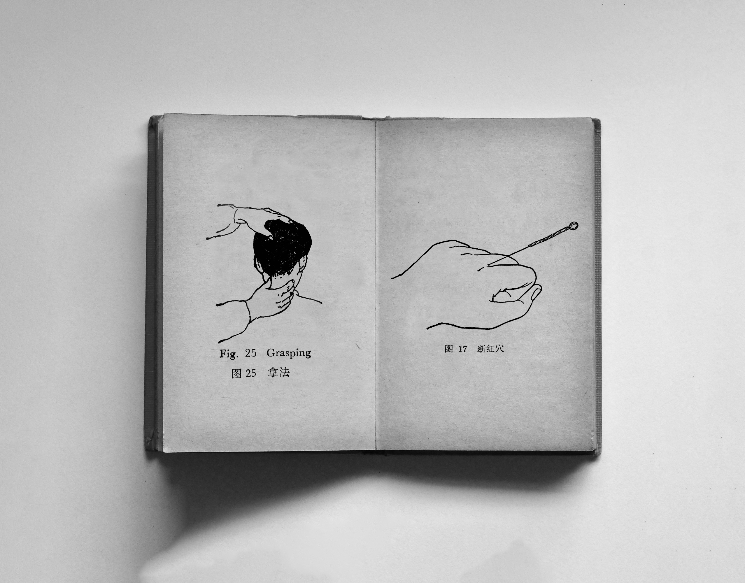 An open book with two graphics from Chinese textbooks. Left page the massage grip Tui, grasping, right page an acupuncture needle in a hand closed into a loose fist.